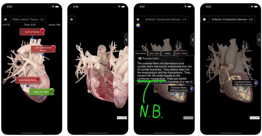 What exactly is the Heart Pro III - iPhone mobile app? This app will not work on iPhone 3GS models. The Heart Pro III is presented by 3D4Medical in collaboration with Stanford University School of Medicine.